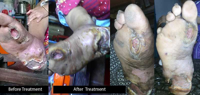 thangam-before-after