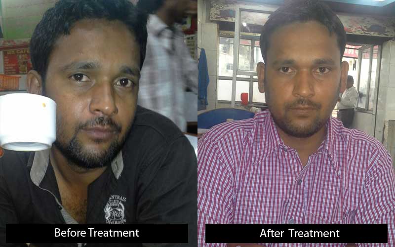 rizwan-before-after