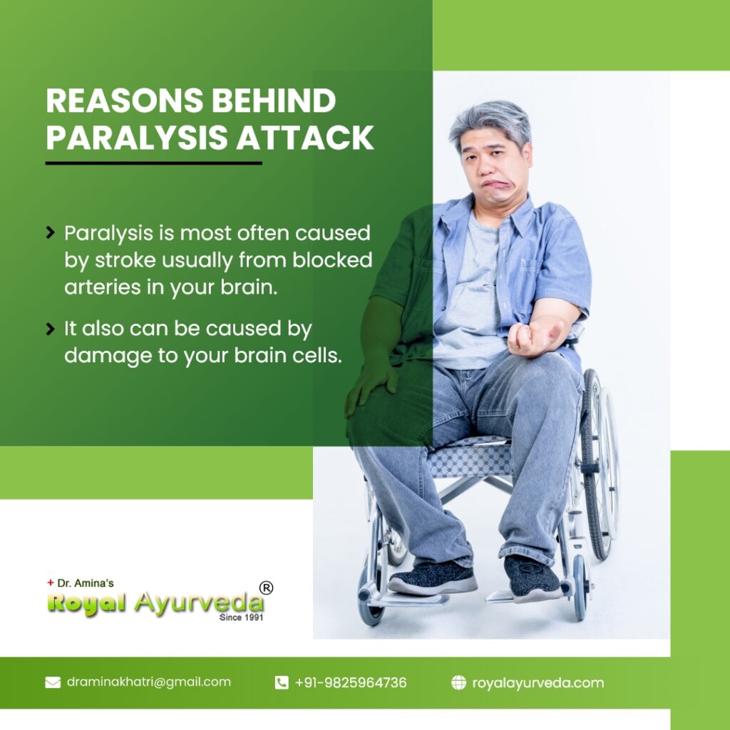 exercise cycle for paralysis patient